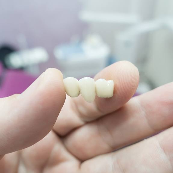 A hand holding a dental bridge