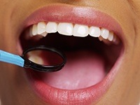 Closeup of smile during dental exam