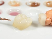 Dental crown restoration before placement