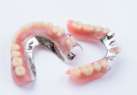 Partial Dentures