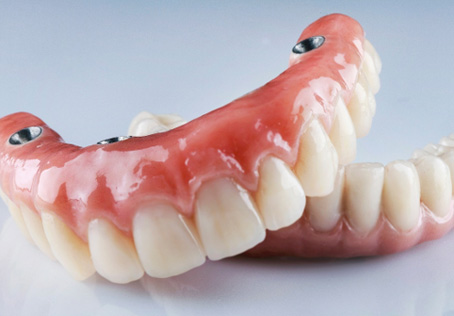 A pair of implant dentures