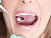 Closuep of patient during dental treatment