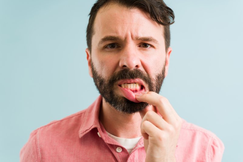 A young man suffering from mild gum disease