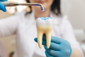 Dentist showing a tooth filling.