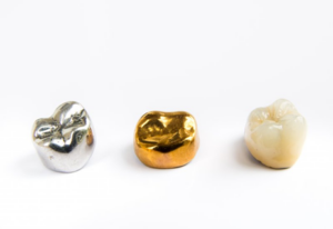 Two metal crowns sitting next to a tooth-colored crown